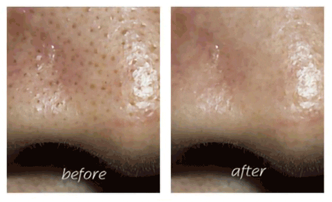 Anatomylaborg giphyupload exfoliating wand GIF