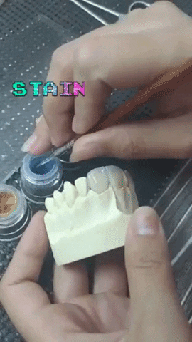 apostoldental dentistry ceramics veneers dental laboratory GIF