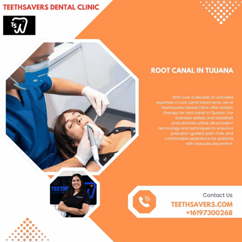 Root Canal In Tijuana GIF