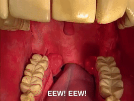 200.gif?cid=fc005b08b6829a758735aaeb9c9d44872f58ab1af2c1b172&rid=200.gif&ct=g