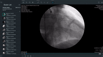 craig_purview cine medical imaging dicom GIF