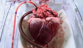GifsdaFisio coracao fisioterapia heart human GIF
