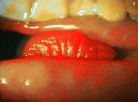 lips GIF by Daily Mail Online
